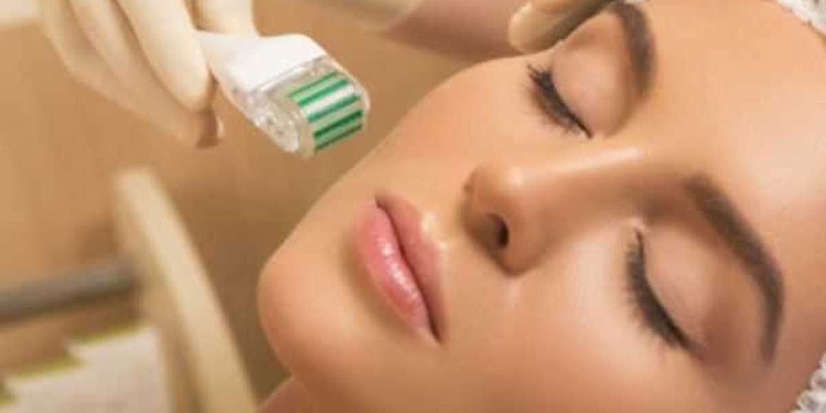 Microneedling session cost