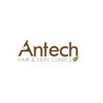 Antech Hair Clinic Profile Picture