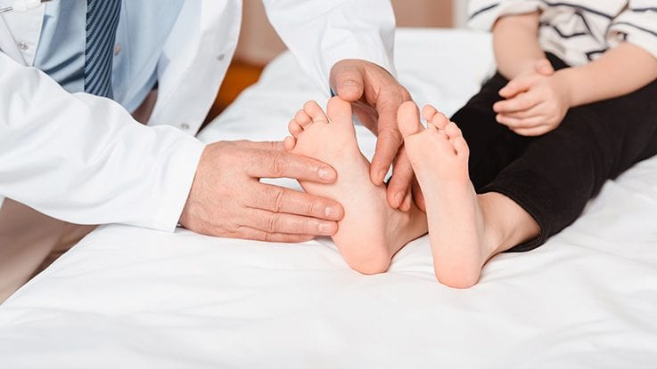 Crawled Toes | Low Lazer in Richmond Hill | Podiatry Charters Towers