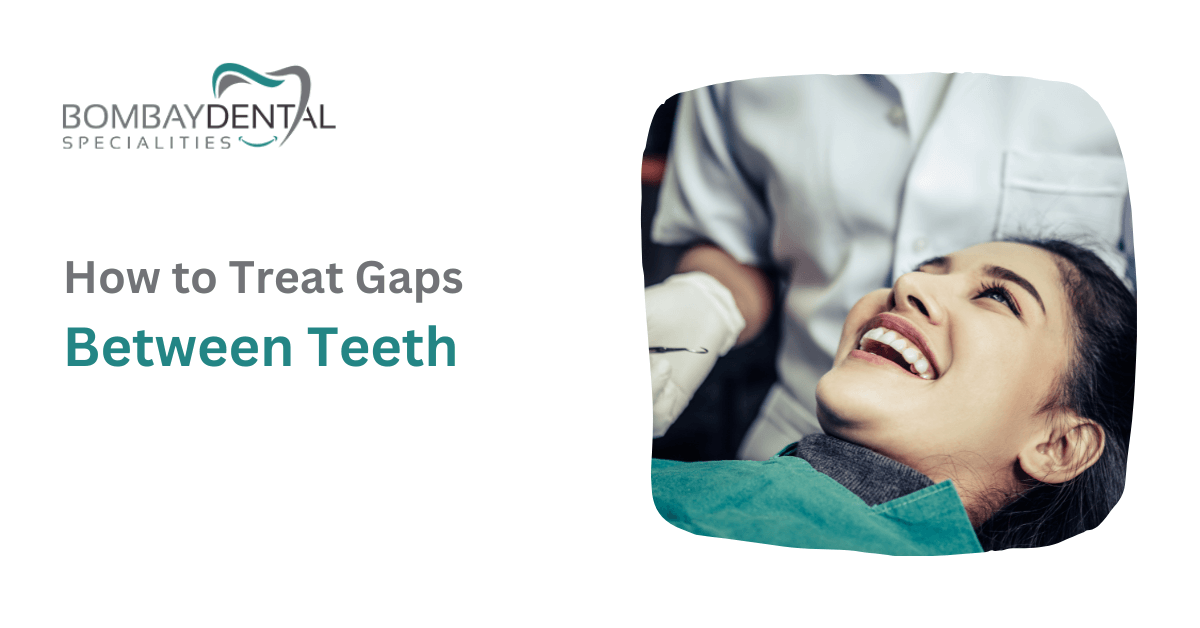 Treatment Options For Fixing a Gap Between Teeth