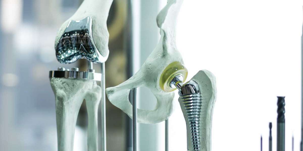 America Orthopedic Biomaterial Market Players Share Report with Revenue Growth & Top Strategies