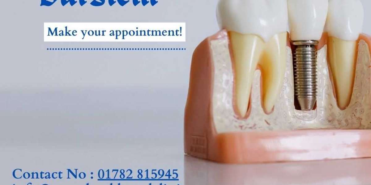 Best Dentist in Stoke - Guide to Finding Quality Dental Care!