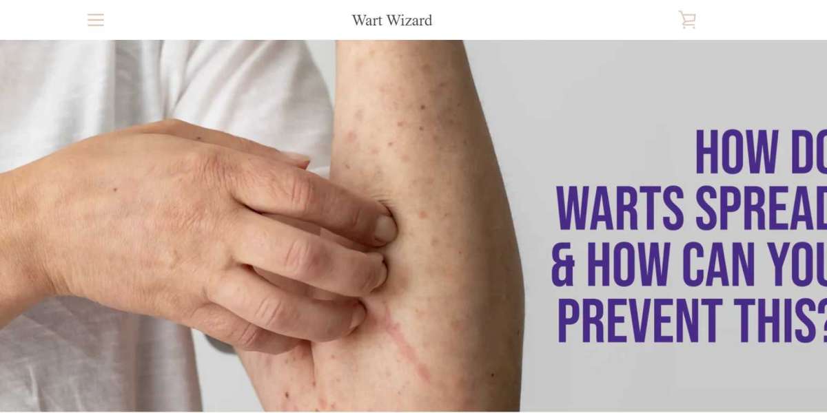 How Do Warts Spread and How Can You Prevent This?