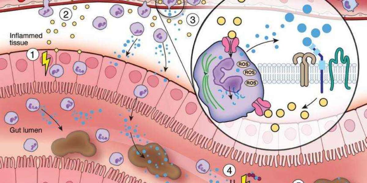 Calprotectin as a Biomarker of Inflammation Disease