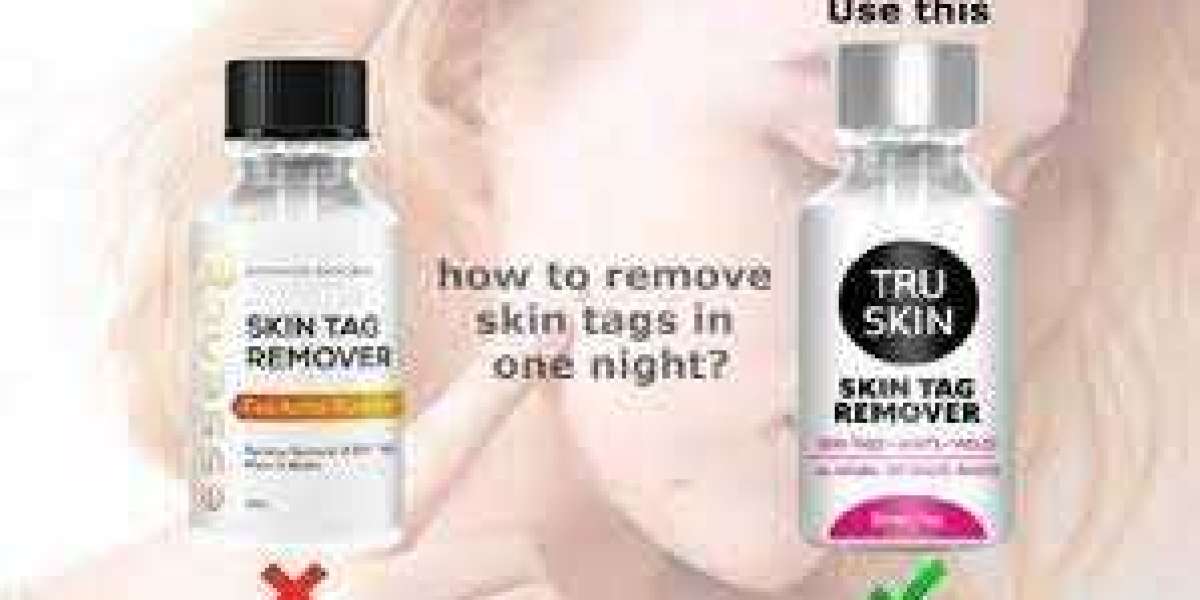 6 Super Smart Ways to Save Money on Tru Skin Tag Remover Review