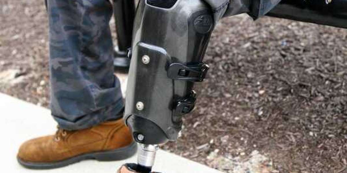 The Perfect Fit: Transforming Mobility with Adjustable Prosthetic Sockets: