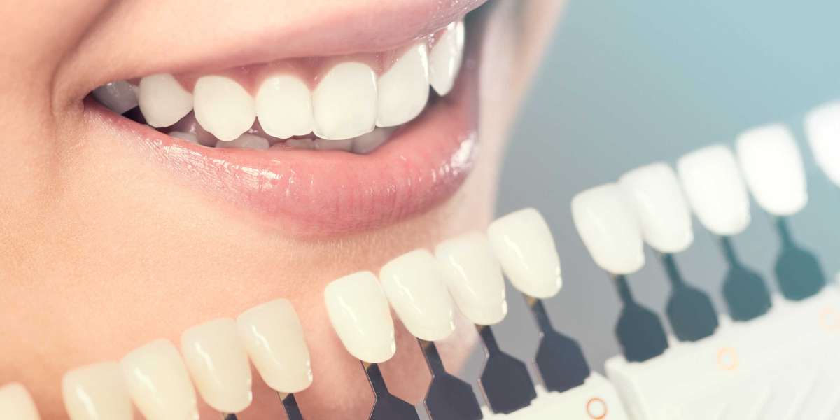 Brighten Your Smile: A Comprehensive Guide to Teeth Whitening