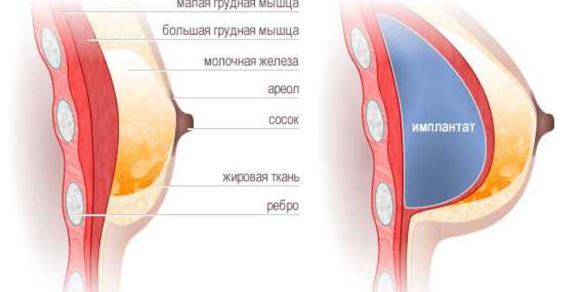 Article Picture