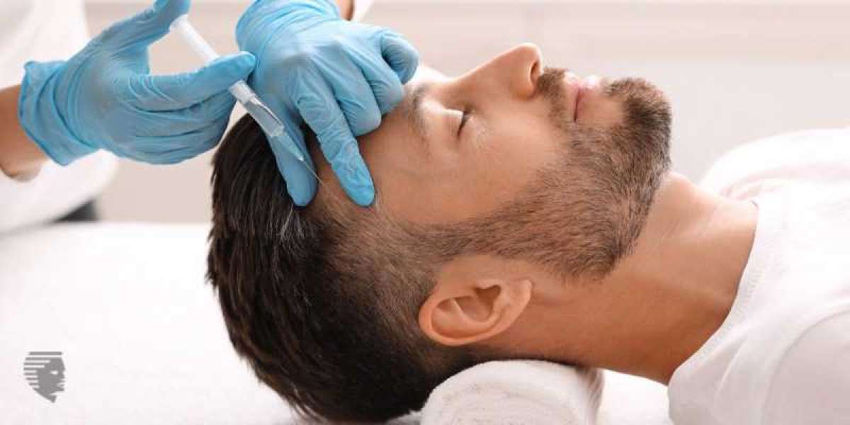 Hair Transplant Clinic in Kerala