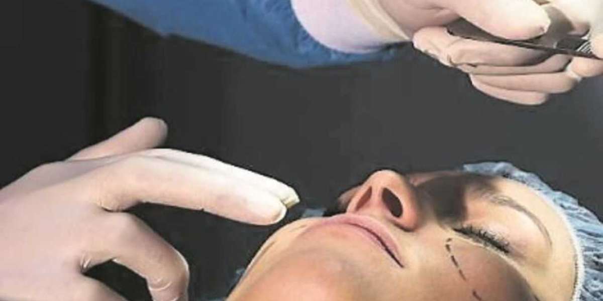 Understanding the Recovery Process of Korean Face Surgery: Dispelling Myths and Unveiling Realities
