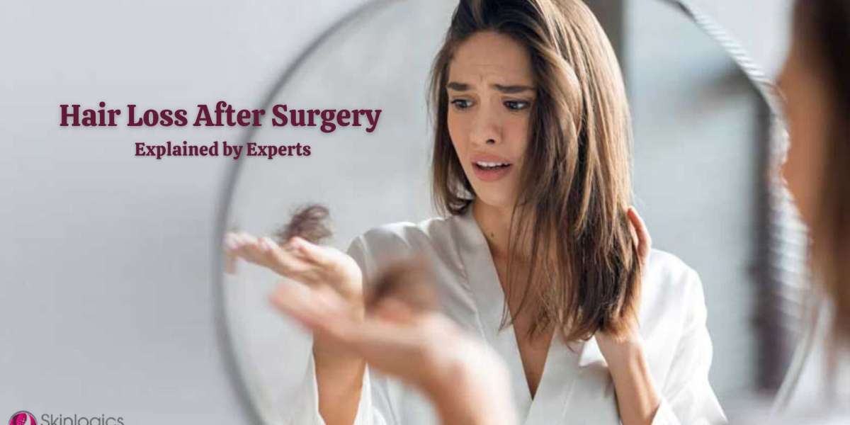 Hair Loss After Surgery Explained by Experts