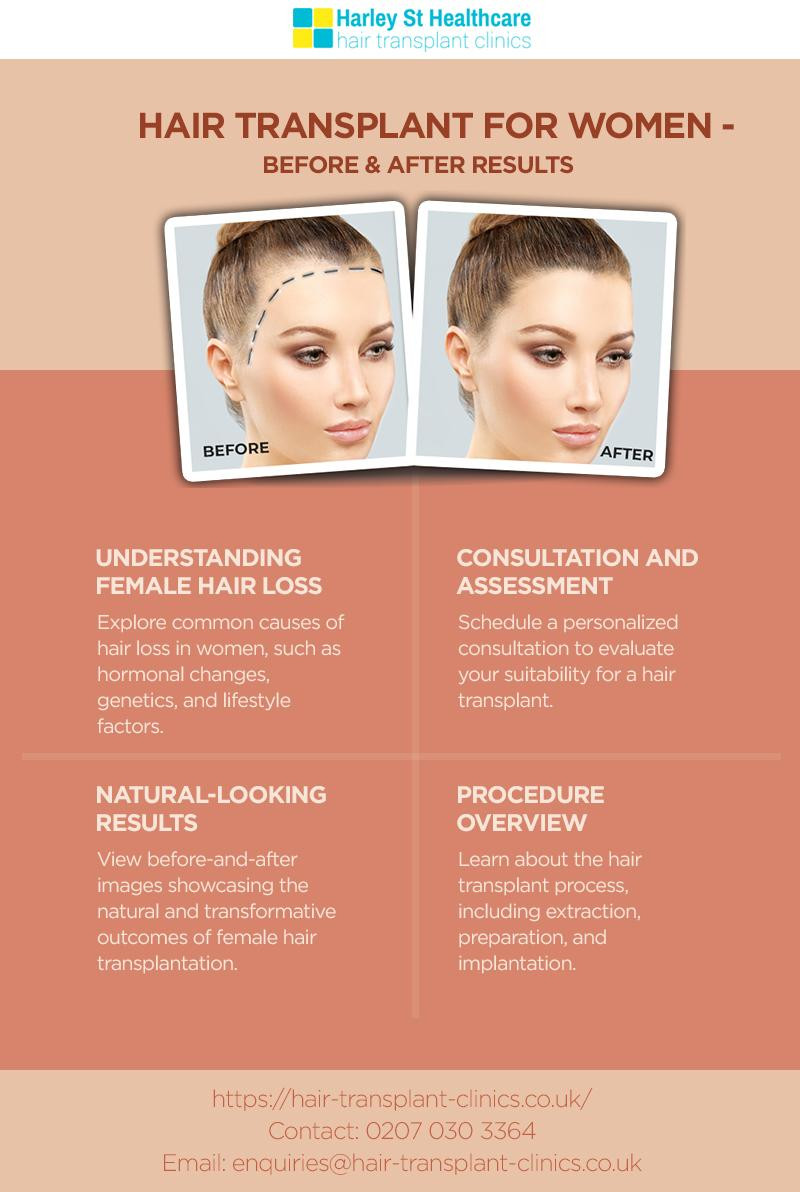 Hair Transplant for Women - Before & After Results - JustPaste.it