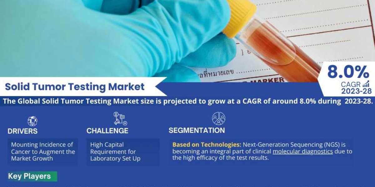 Solid Tumor Testing Market Trends, Share, Companies and Report 2023-2028