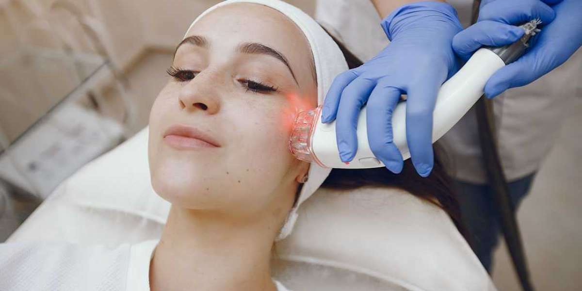 Unlocking The Wonders of Laser Toning for Skin