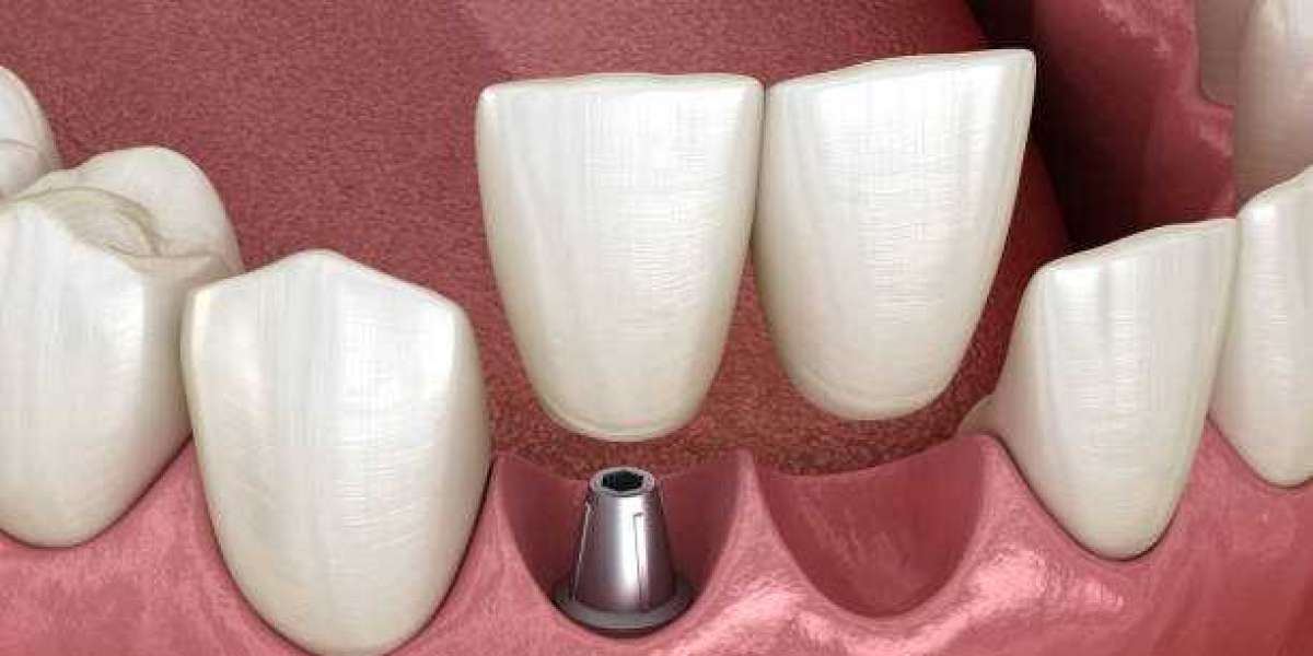 Tooth Regeneration is Estimated to Witness High Growth Owing to Expanding Geriatric Population