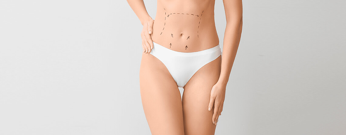 What to Look for When Considering Liposuction Costs? Dr Rajat