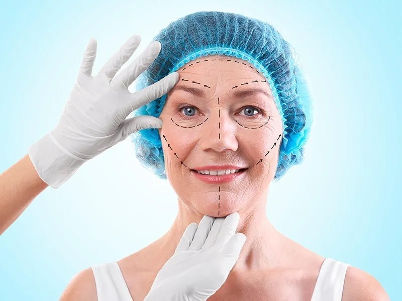 Face Lifting Costs Columbia: Things to Know - AtoAllinks