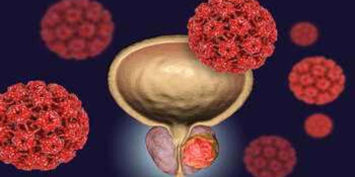 Are You Aware Of The Main Causes Of Bladder Cancer?